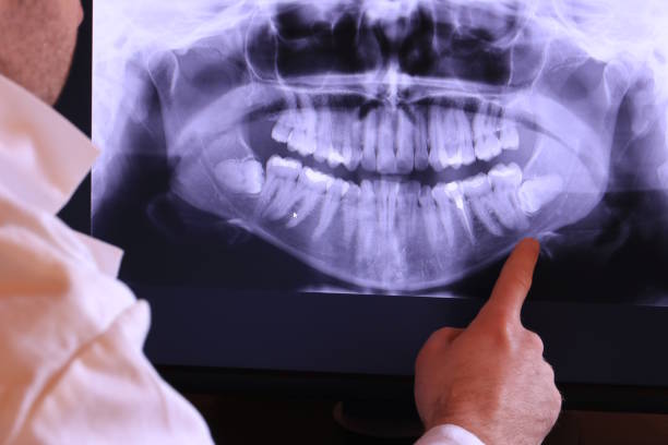 Best Cracked Tooth Emergency Dentist  in Mendon, IL